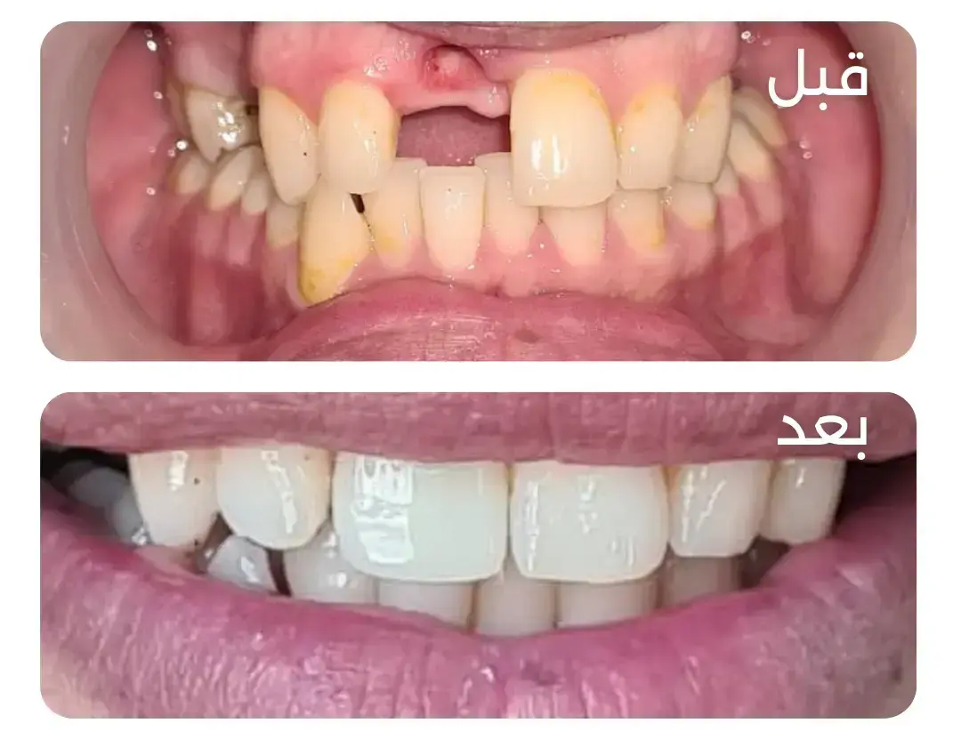 Copy of قبل (10) (1)